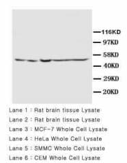PSEN2 / Presenilin 2 Antibody (aa319-334)