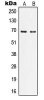 IQCB1 Antibody (Internal)