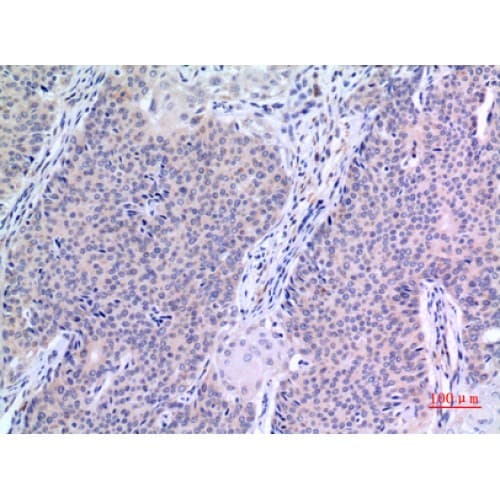 Polyclonal Rabbit anti-Human VGF Antibody (441-490 aa, Internal, IHC, WB)
