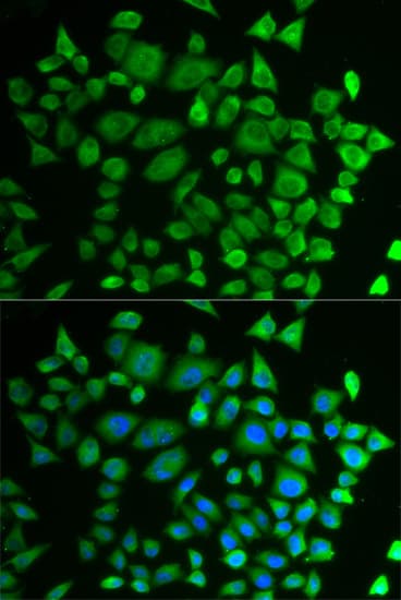 Polyclonal Rabbit anti-Human PH4 / P4HTM Antibody (IHC, IF, WB)