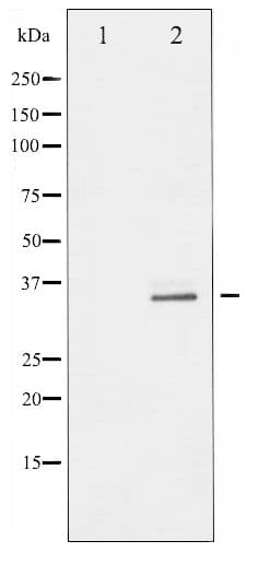 RPS6 / Ribosomal Protein S6 Antibody (phospho-Ser235)