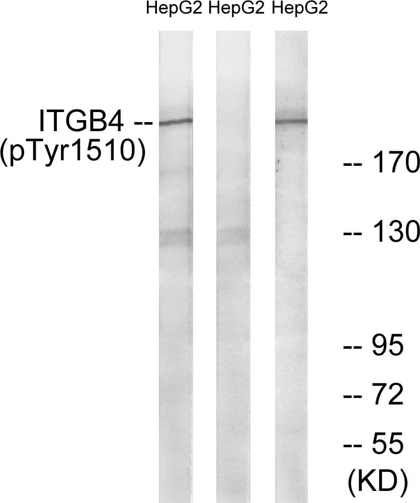 ITGB4 / Integrin Beta 4 Antibody (phospho-Tyr1510)