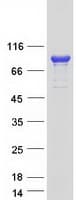 Human ADD3 Protein (Recombinant Myc-DDK (Flag))