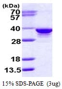 Human RPIA / RPI Protein (Recombinant His)