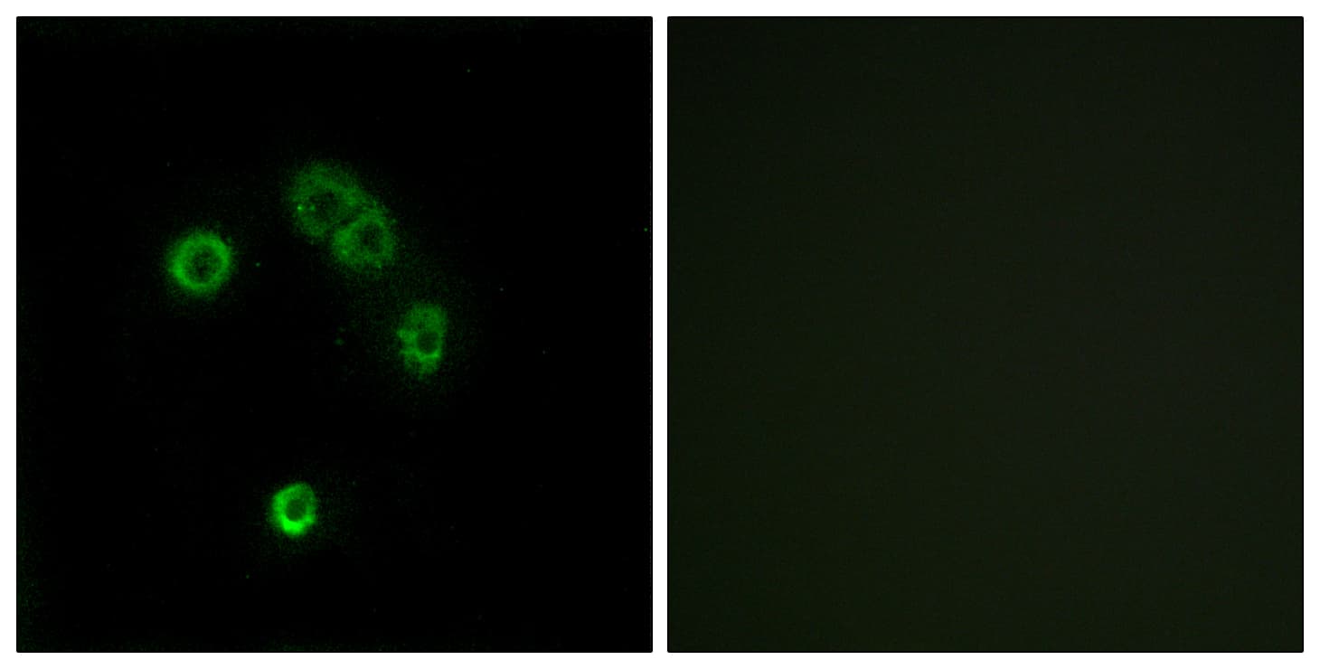 Polyclonal Rabbit anti-Human T2R13 / TAS2R13 Antibody (aa123-172, IF, WB)