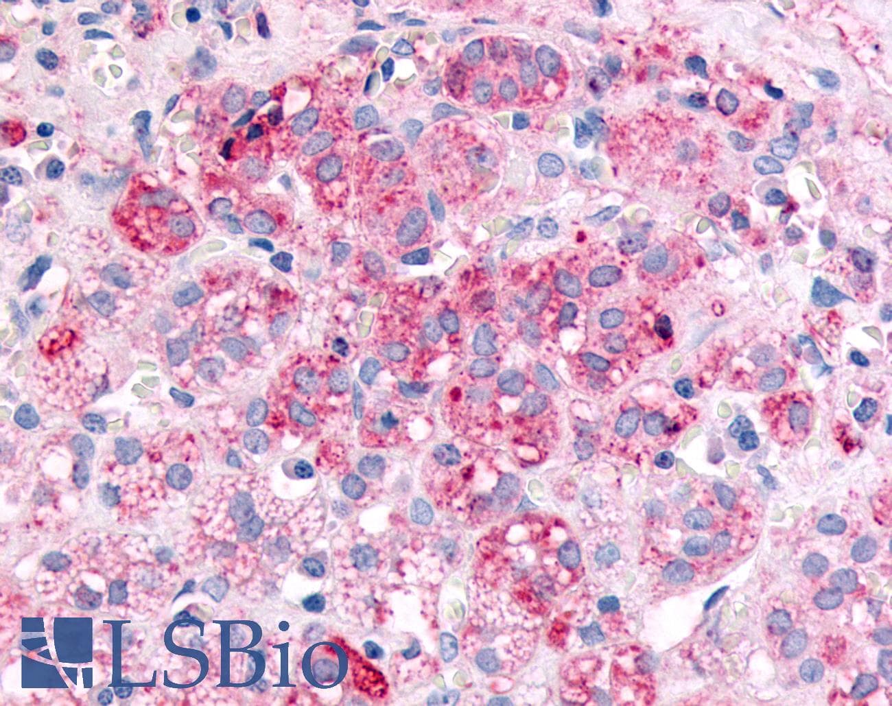 IHC-plus™ SPHK / SPHK1 Antibody (N-Terminus)