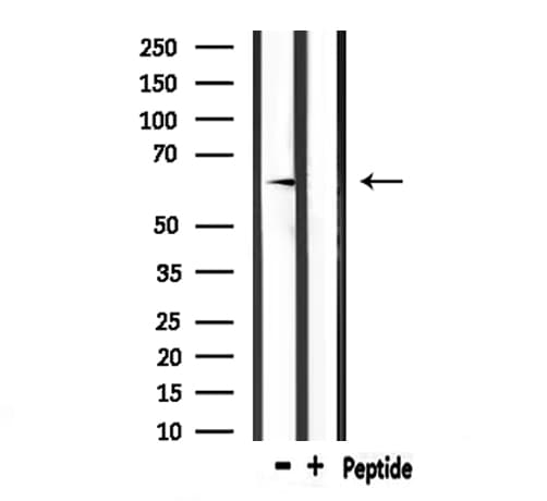 Polyclonal Rabbit anti-Human SELE / CD62E / E-selectin Antibody (IHC, IF, WB)