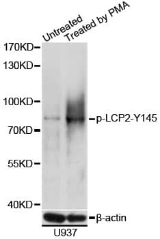LCP2 / SLP-76 Antibody (phospho-Tyr145)