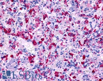 PathPlus™ CCR8 / CD198 Antibody (C-Terminus)