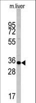 Polyclonal Rabbit anti-Human CASP6 / Caspase 6 Antibody (aa235-263, IHC, WB)