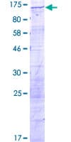 Human DDX10 Protein (Recombinant GST)