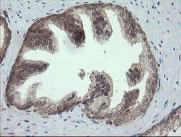 PIK3CG / PI3K Gamma Antibody (clone OTI1A9)
