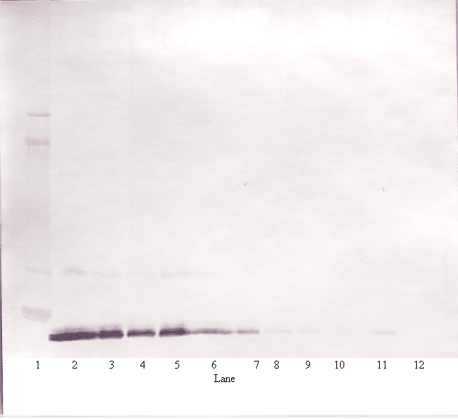 Polyclonal Rabbit anti-Human IL19 Antibody (WB)