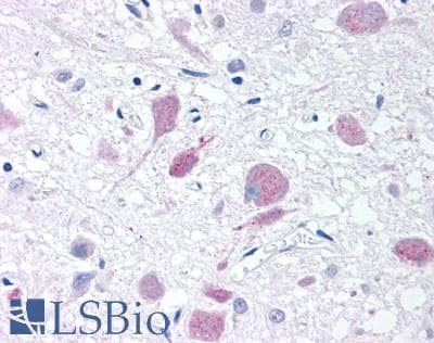 PathPlus™ PLA2G3 Antibody (Internal)