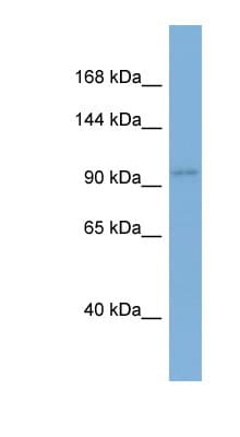 AGO1 / EIF2C Antibody (N-Terminus)