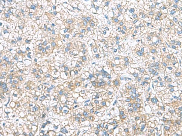 Polyclonal Rabbit anti-Human RAB13 Antibody (IHC)