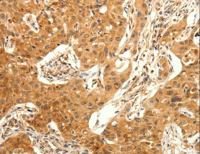 Polyclonal Rabbit anti-Human TRPC6 Antibody (IHC)