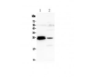 GSTA1+GSTA2+GSTA3+GSTA4+GSTA5 Antibody