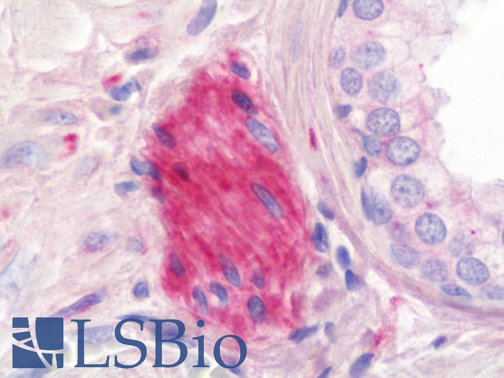 IHC-plus™ ANK2 / Ankyrin B Antibody (aa203-496, clone S105-17)