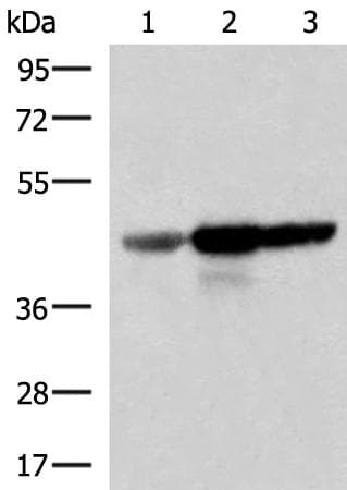 FDFT1 / Squalene Synthase Antibody