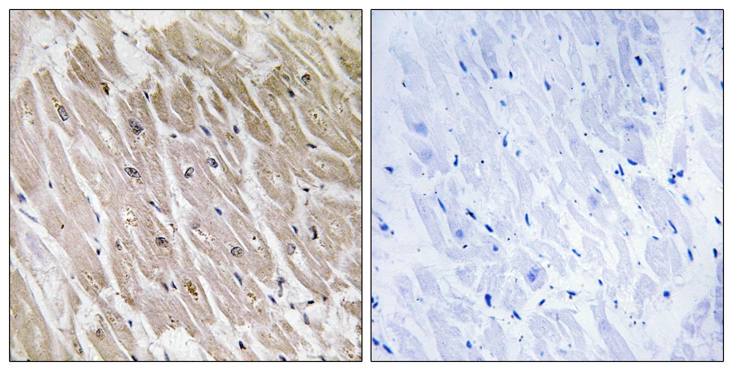Polyclonal Rabbit anti-Human ACAD10 Antibody (IHC)