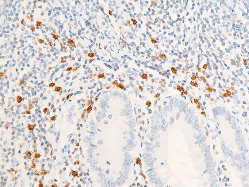 Polyclonal Rabbit anti-Human ERBB2 / HER2 Antibody (phospho-Tyr1112, IHC, IF, WB)