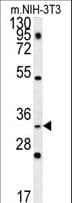 ENKUR Antibody (aa109-137)