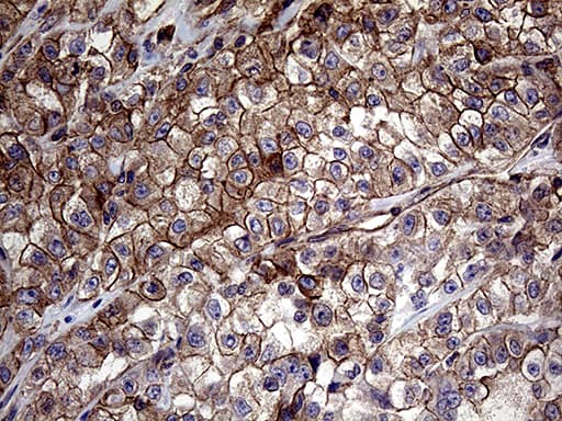 GLS2 / Glutaminase 2 Antibody (clone OTI4C10)
