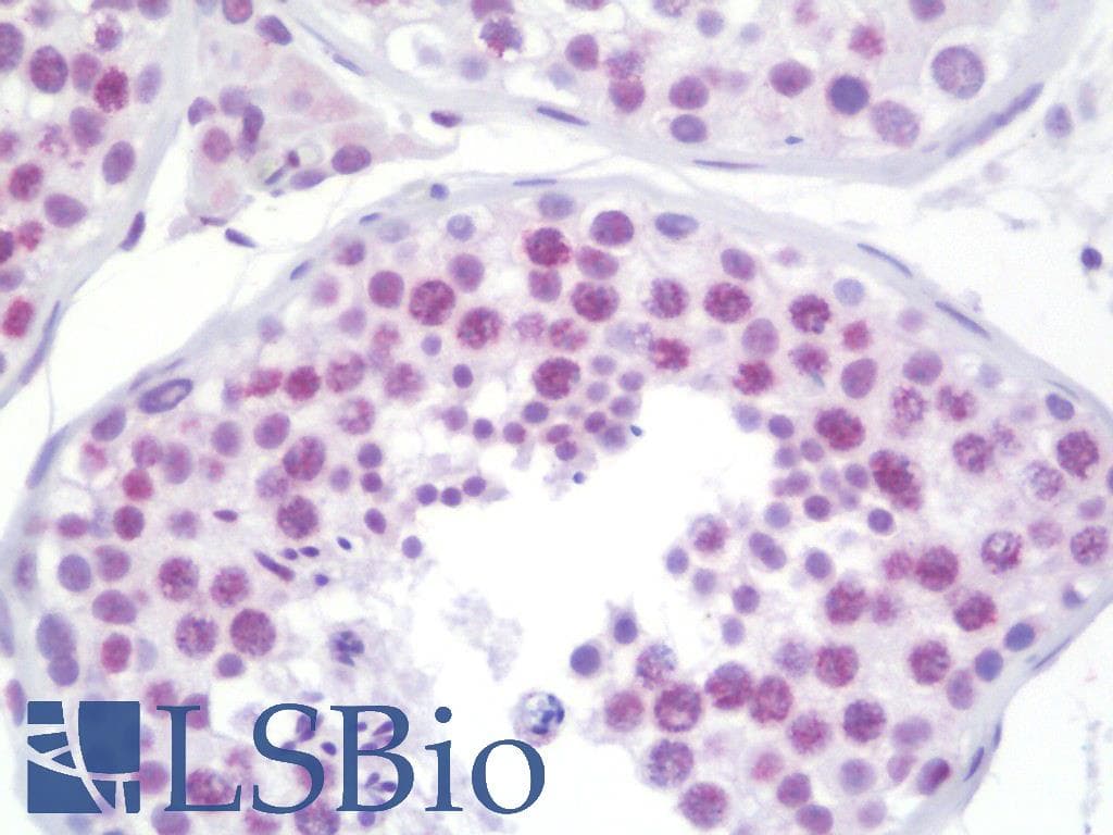 CEP152 Antibody (aa841-890)