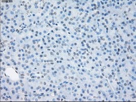 SORD / Sorbitol Dehydrogenase Antibody (clone OTI2A10)