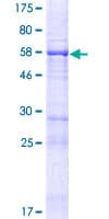 Human FAM53B Protein (Recombinant GST)