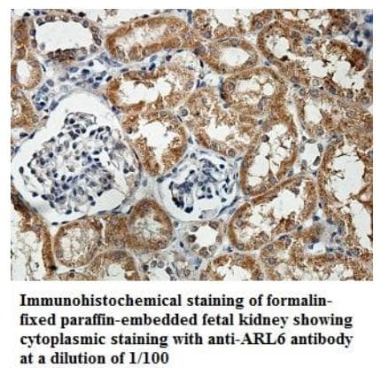 Polyclonal Rabbit anti-Human ARL6 Antibody (aa2-186, IHC)