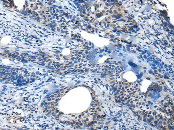 Polyclonal Rabbit anti-Human SAA4 Antibody (IHC, WB)