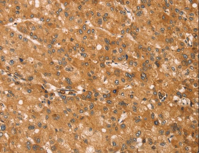 Polyclonal Rabbit anti-Human SNAP29 Antibody (IHC)