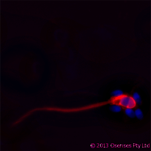 LL37 / Cathelicidin Antibody (clone OSX12)