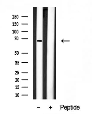 DYRK2 Antibody