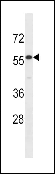 IL17RE Antibody (aa87-116)