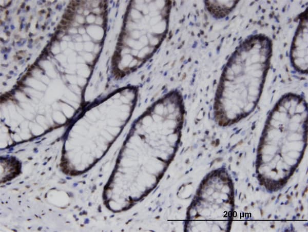 UBASH3B / STS-1 Antibody (clone 3G7)
