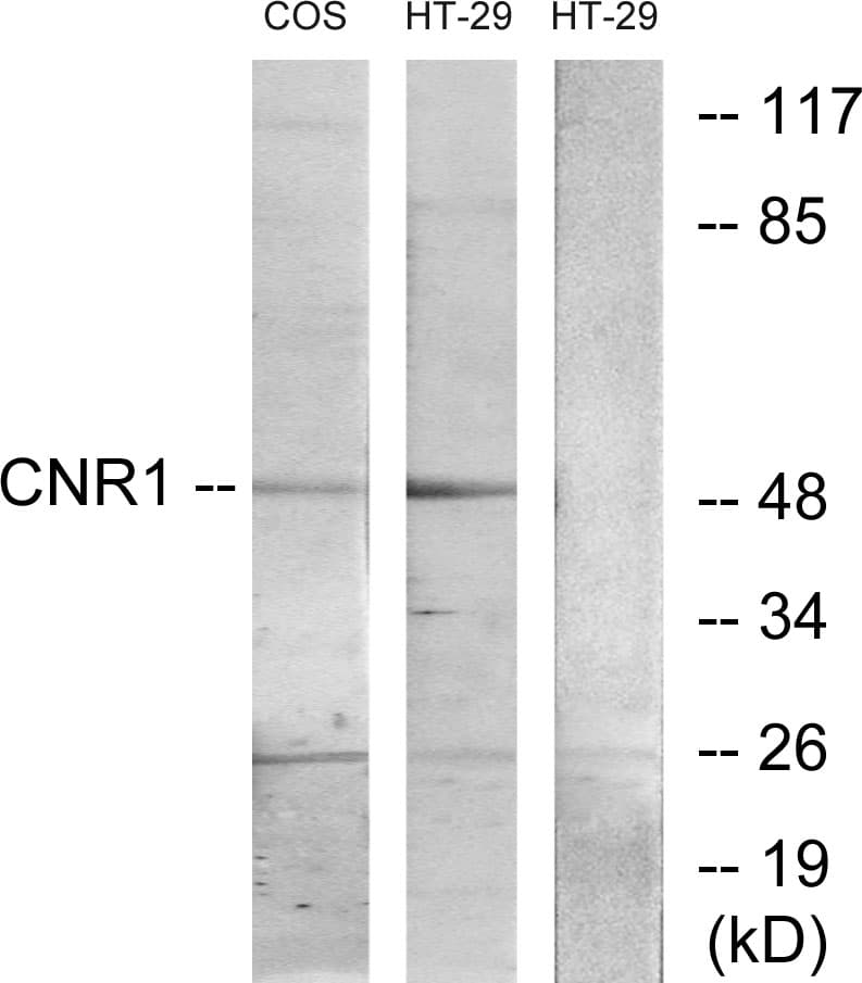 Polyclonal Rabbit anti-Human CNR1 / CB1 Antibody (aa151-200, IHC, IF, WB)