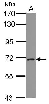IHC-plus™ Polyclonal Rabbit anti-Human PICALM / CALM Antibody (IHC, WB)