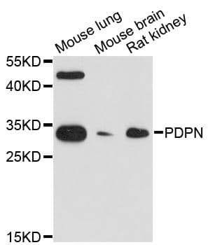 IHC-plus™ Polyclonal Rabbit anti-Human PDPN / Podoplanin Antibody (IHC, WB)
