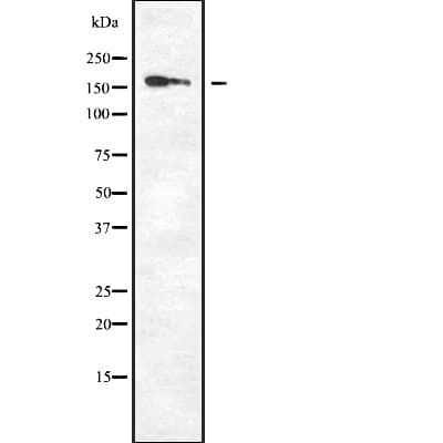 Polyclonal Rabbit anti-Human DAPK1 / DAP Kinase Antibody (IHC, WB)