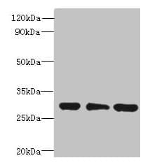 Polyclonal Rabbit anti-Human HDHD3 Antibody (IHC, WB)