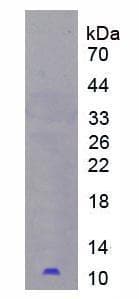 Human PI3 / Elafin Protein (Recombinant His)
