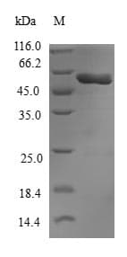 Human GNB1L / FKSG1 Protein (Recombinant GST, N-terminus)