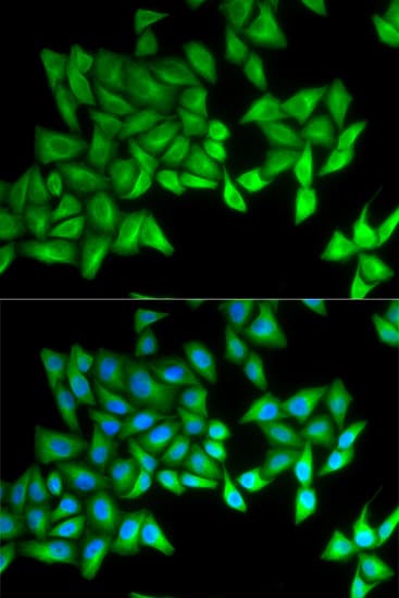 BPI Antibody