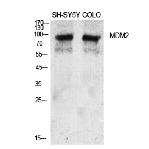 Polyclonal Rabbit anti-Human MDM2 Antibody (110-190 aa, IHC, IF, WB)