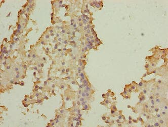 SOHLH2 Antibody