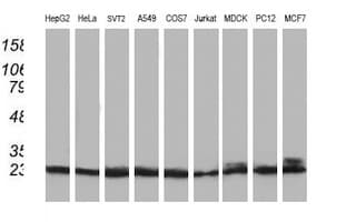 PNMT Antibody (clone OTI1D2, Carrier-free)
