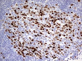 TOP2A / Topoisomerase II Alpha Antibody (aa1100-1531, clone 1D2, Carrier-free)